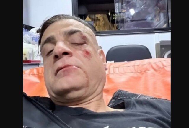 Άγριος ξυλοδαρμός Youtuber σε σταθμό του μετρό από πορτοφολάδες – Δείτε βίντεο Άγριος-ξυλοδαρμός-youtuber-σε-σταθμό-του-μετρό-από-πορτοφολάδες-–-Δείτε-βίντεο