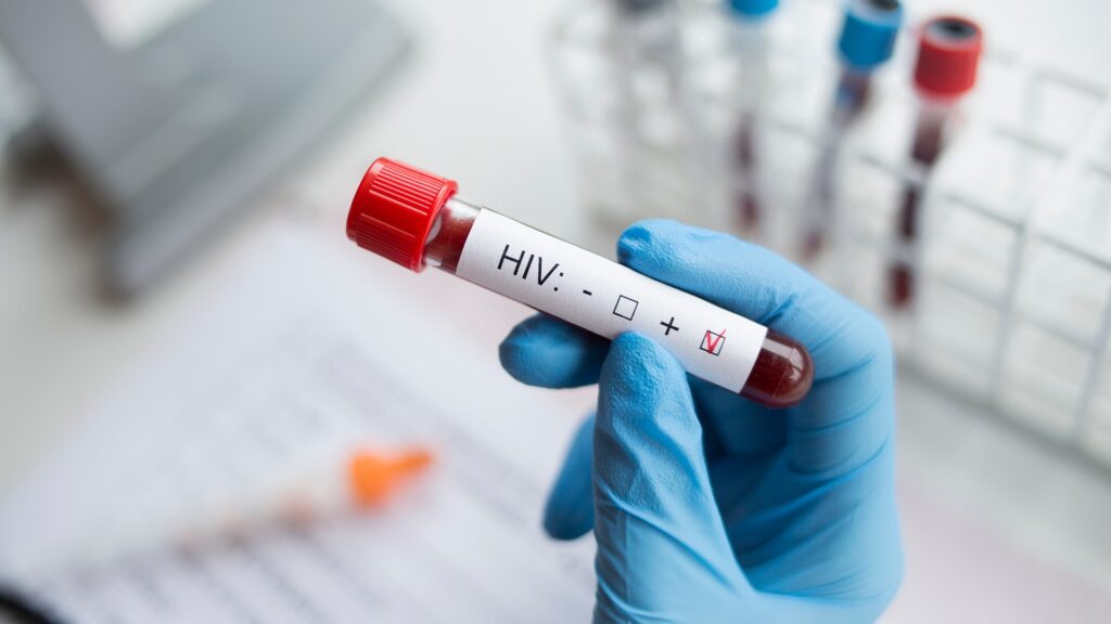 Παγκόσμια Ημέρα κατά του AIDS: Πάνω από 21.800 περιστατικά στην Ελλάδα – Πάνω από 3.700 νεκροί Παγκόσμια-Ημέρα-κατά-του-aids:-Πάνω-από-21800-περιστατικά-στην-Ελλάδα-–-Πάνω-από-3.700-νεκροί